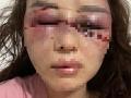 Vụ cán bộ Quản lý thị trường bị tố đánh đập, lột đồ người tình: Diễn biến mới nhất