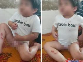 Vụ dì ruột đánh cháu 4 tuổi bầm tím khắp người ở Hà Tĩnh: Trưởng Công an huyện nói gì?