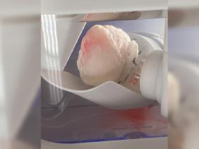 "Trái tim ma" mở ra hy vọng mới cho bệnh nhân cần cấy ghép tim