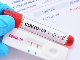 "Giới chủ" đứng sau hệ sinh thái doanh nghiệp chi hàng nghìn tỷ nhập khẩu kit test COVID-19