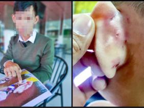 Khởi tố cô giáo mầm non đánh trẻ gây thương tích ở Kiên Giang