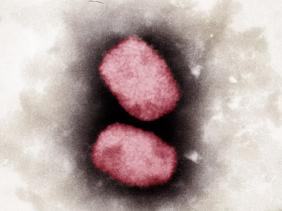 Truy vết tất cả các trường hợp tiếp xúc với với ca đậu mùa khỉ