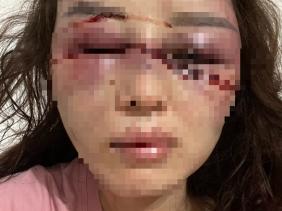 Vụ cán bộ Quản lý thị trường bị tố đánh đập, lột đồ người tình: Diễn biến mới nhất