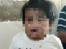 Bé gái 4 tuổi nhập viện với nhiều vết thương: Công an làm việc với dì ruột