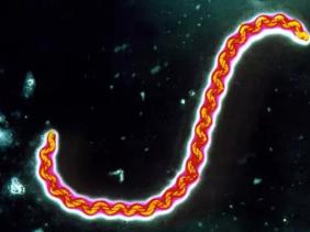 Ghi nhận 2 trường hợp nhiễm xoắn khuẩn vàng da tại Bà Rịa - Vũng Tàu