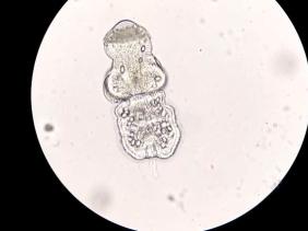 Việt Nam ghi nhận ca bệnh thứ 2 có sán chó trong tim