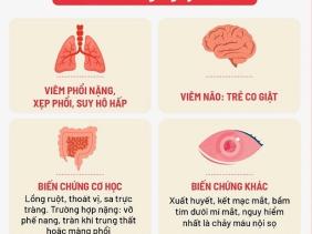 Ca bệnh ho gà tại Hà Nội tăng cao