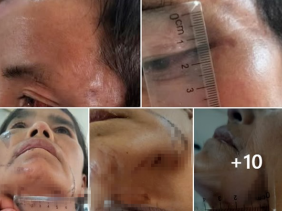 Điều tra vụ bắt giữ người trái pháp luật và hành hung vì nghi bị bỏ bùa ở Điện Biên