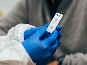 Nhiều người nhiễm biến thể Omicron thậm chí không nhận ra họ mắc COVID-19