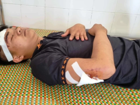 Vụ tàu cá bị đâm chìm trên biển: Ngư dân thoát nạn bàng hoàng kể lại giây phút sinh tử