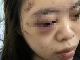 Vụ thiếu nữ 17 tuổi bị đánh "hội đồng", quỳ xin lỗi: Nạn nhân kể lại sự việc, tiết lộ cô gái "cầm đầu"
