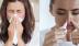 5 biện pháp khắc phục sổ mũi, nghẹt mũi hiệu quả trong thời tiết mưa rét