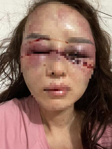 vu can bo quan ly thi truong bi to danh dap lot do nguoi tinh dien bien moi nhat vu can bo quan ly thi truong bi to danh dap lot do nguoi tinh dien bien moi nhat