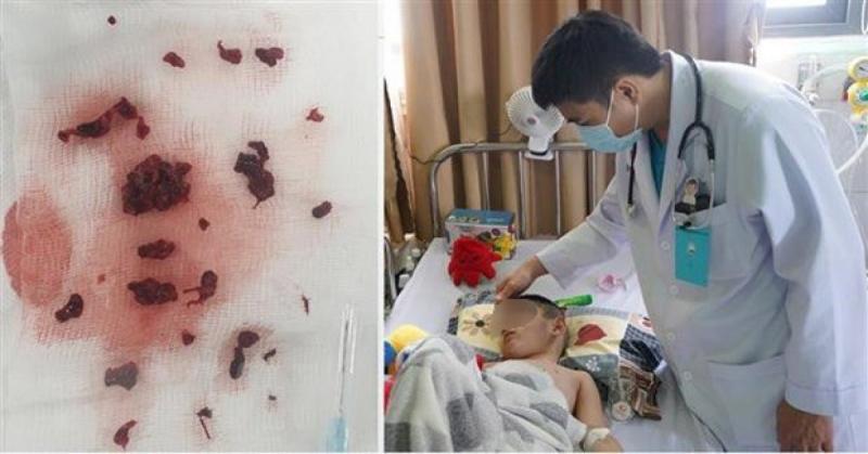 canh bao dot quy o tre em hinh anh 1